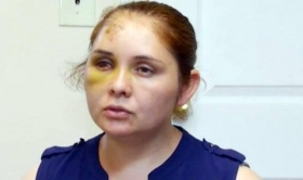 Se brind&oacute; asesor&iacute;a jur&iacute;dica y la familia solicit&oacute; apoyo en el &aacute;rea de salud mental
