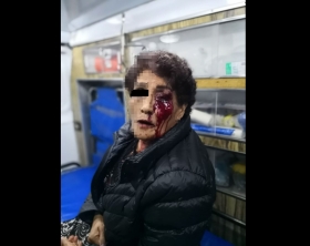 El ayuntamiento investiga si existi&oacute; una agresi&oacute;n de los uniformados  