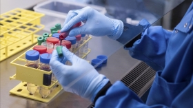 AstraZeneca comenz&oacute; en Estados Unidos ensayos en humanos